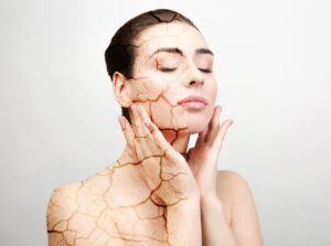 Woman with cracked skin